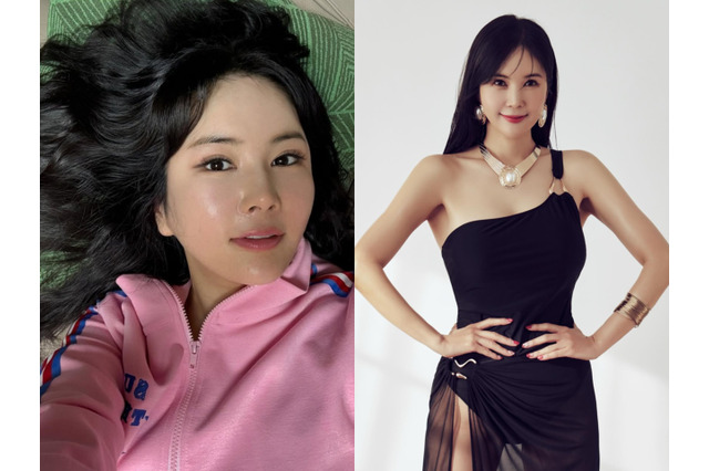 「整形すれば世界中の男性がプロポーズしてくるのではと心配した」計4回の手術を受けた韓国タレントの現実 画像