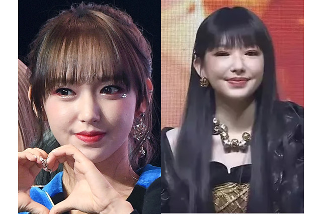 整形失敗？あの美少女が…大きく変わったビジュアルでファンを驚かせた元K-POPアイドル、原因とは 画像