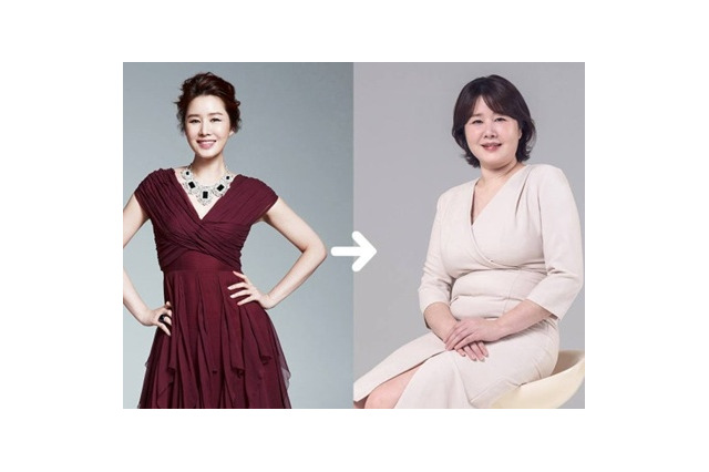 体重が増加してうつ病にも…ミス・コリア出身の美女に何が起きたのか 画像