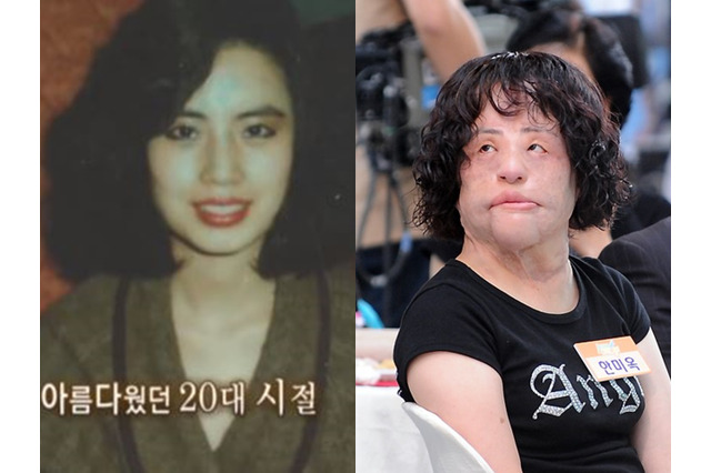 美女がなぜ“扇風機おばさん”に？死去の秘話が明かされる…違法整形、顔に工業用シリコンを注入 画像