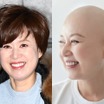 ファンのBTSに言及中に…韓国タレント、抗がん剤治療の副作用を吐露「目があまり見えなくなった」