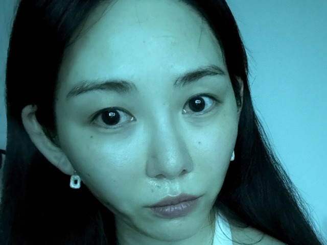 顔面に大やけど負ったクォン・ミナ、激変した近況に心配の声「かなり痩せたのでは」