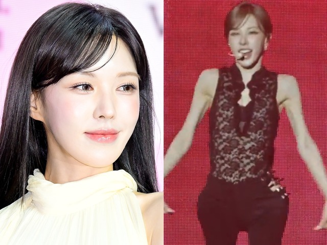 あまりにも痩せた姿に「骨のよう」、摂食障害を疑う声まで…Red Velvet・ウェンディに心配相次ぐ