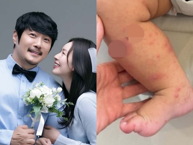 韓国人夫のために日本国籍を捨てた女性、生後8カ月の息子が手足口病に「先輩ママの話が聞きたい」