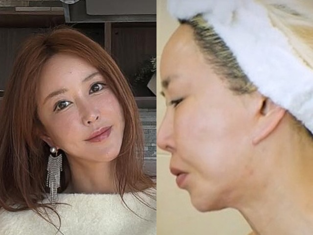 横浜で生まれ育った元韓国トップアイドル、自身もショックを受けた外見の変化「私の顔どうした」