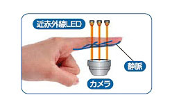 透過光撮影方式を採用