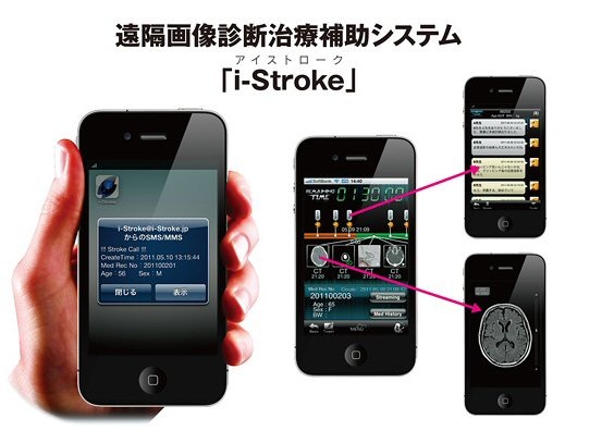 i-Stroke