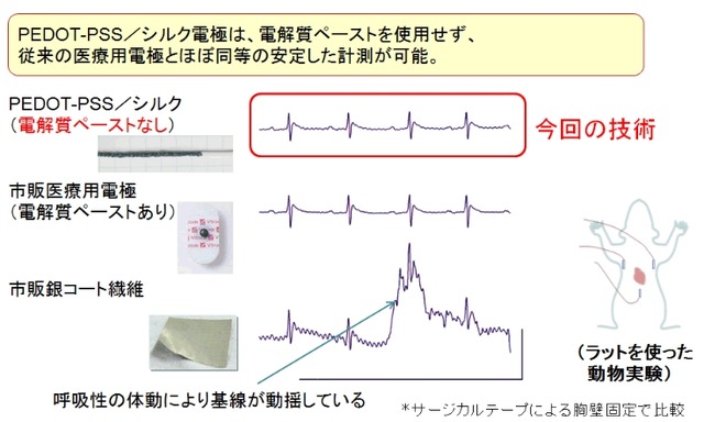 心電図計測例 