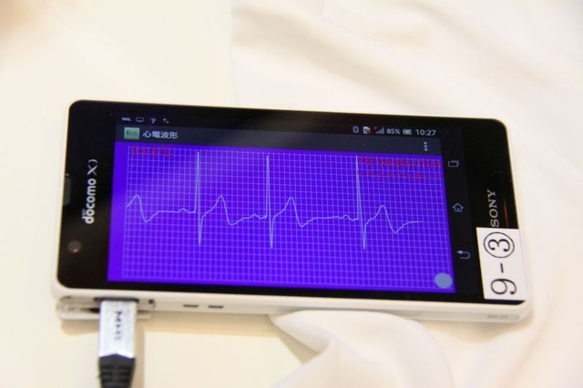 アプリしだいでスマホやタブレットが心電図計にもなる