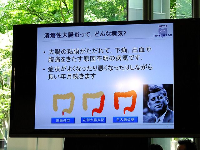 IBDを理解する日 2014疾患啓発イベント