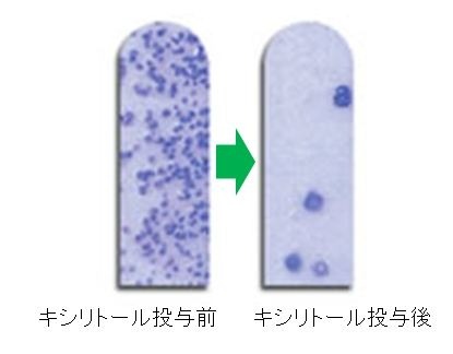 キシリトールを投与する前（左）と投与後（右）に、ミュータンス菌検査キット「デントカルトSM」で検査をした結果
