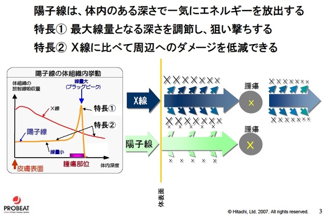 X線治療と違い、患部の深さによってエネルギーを調整できる