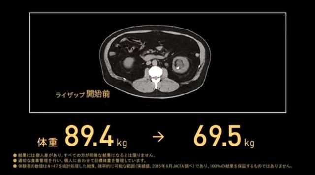 森永氏のダイエット前の腹部MRI