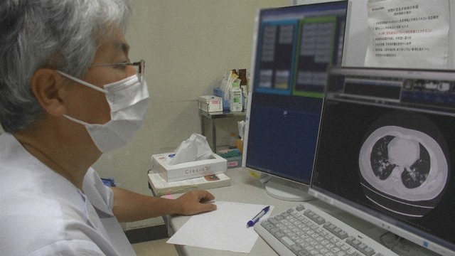 聖マリアンナ医科大学病院　CT画像見る医師（C）NHK
