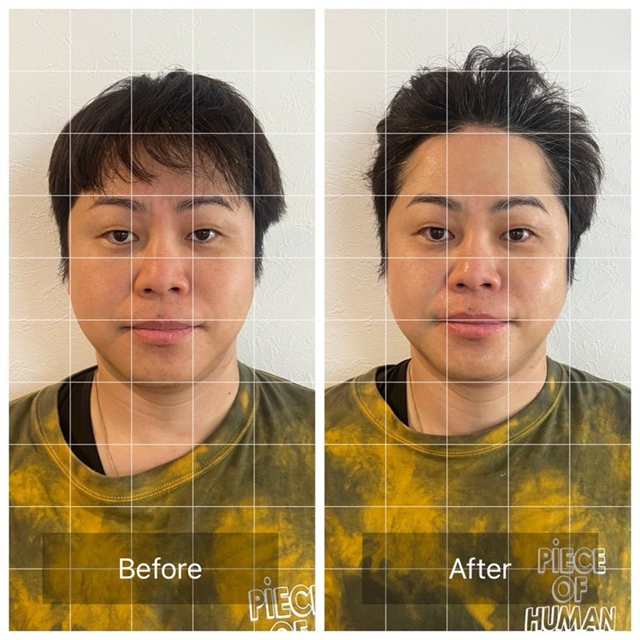 井上裕介（写真は井上裕介の公式ブログより）