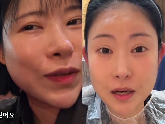 豊胸・整形に総額“1億5000万ウォン”投入の韓国芸人　今度は“耳”を改造「めちゃくちゃ不思議！」