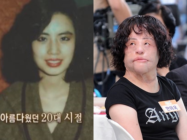 美女がなぜ“扇風機おばさん”に？死去の秘話が明かされる…違法整形、顔に工業用シリコンを注入