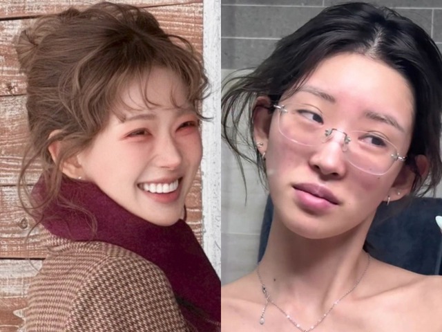 元巨人投手の父を持つ韓国インフルエンサー、衝撃のすっぴんを公開…過去に整形中の顔も披露