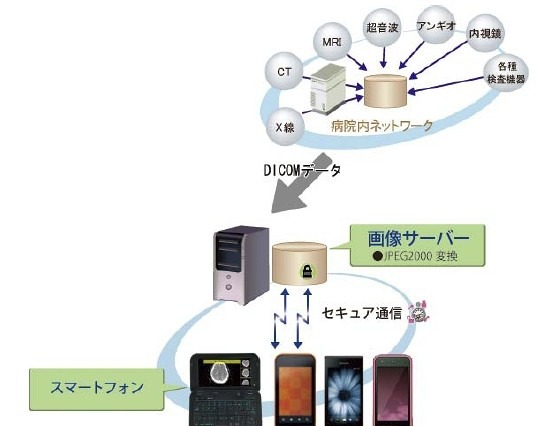 KDDI研、au ISシリーズを活用する医療用画像伝送システム「SmartMIMAS」発売 画像