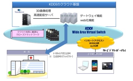 KDDIと米テラリコン、クラウド型「リアルタイム3D医用画像ソリューション」提供開始 画像