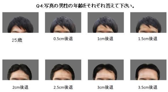頭髪が1cm後退すると、年齢は平均5.7歳老けてみえる? 画像