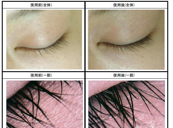 自分のまつ毛を大切に！盛り上がる「まつ毛美容液」市場 画像