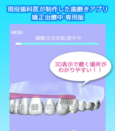 8月8日の「歯並びの日」を前に、矯正歯磨きアプリが登場 画像