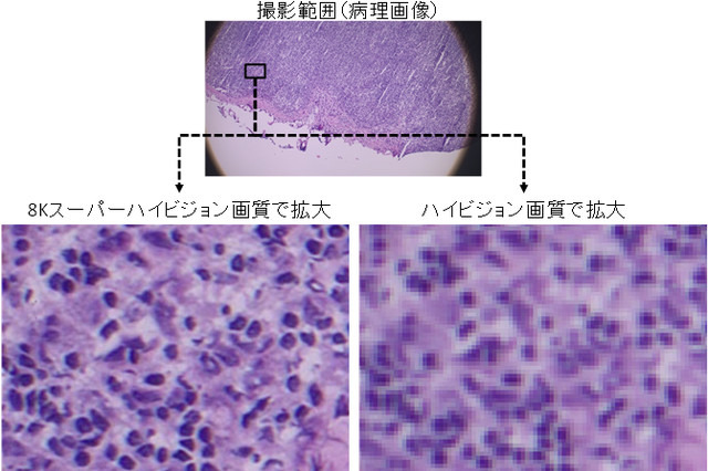8K技術で遠隔医療！NTTデータ経営研究所らが実証実験へ 画像