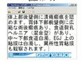内視鏡レポート作成向けに開発された音声入力システムが販売開始 画像