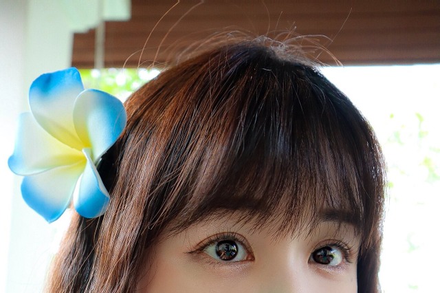 くりえみ「最近やった美容医療」を大公開!糸リフトからヒアル溶かしまで…… 画像
