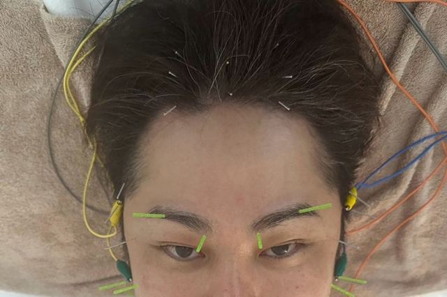 「こわっ！」ノンスタ井上、美容施術中のショット公開し反響 画像