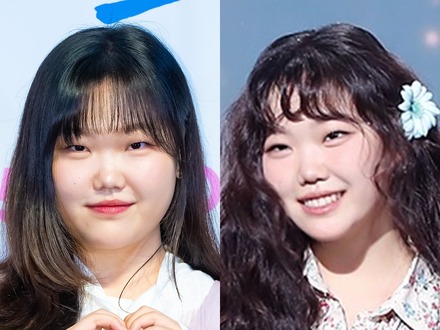 “痩身注射”を疑われた過去も…韓国歌姫、見違えるビジュアルが話題に「もはや別人」