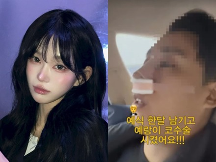 “整形モンスター”と自身も認めた韓国インフルエンサー、婚約者にも整形をさせる 亡き父は元巨人投手