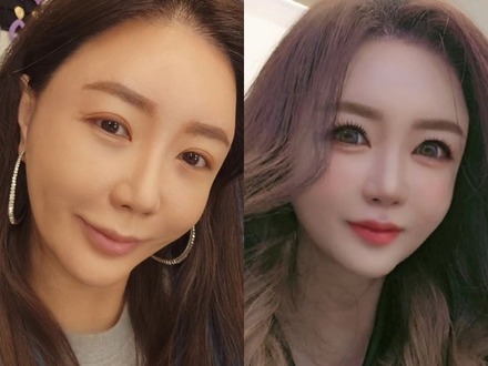 「本当に同一人物?!」15年間の闘病を乗り越えた韓国女優、“激変ビジュ”に驚きの声