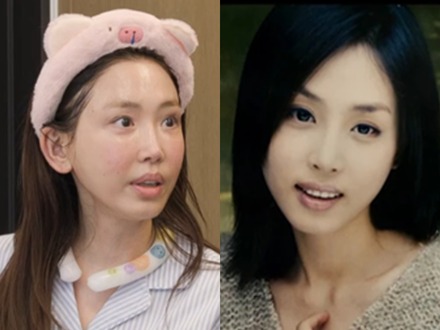 目の整形を7回した韓国女優、その切ない理由「もっと綺麗になろうと欲を出したのではなく…」