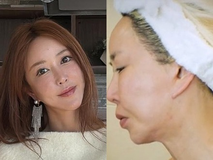 横浜で生まれ育った元韓国トップアイドル、自身もショックを受けた外見の変化「私の顔どうした」