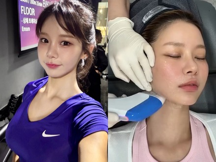 “韓国で最もグラマラス”と言われた元芸人、医師の年下彼氏に顔をお任せ!美容施術VLOGが話題