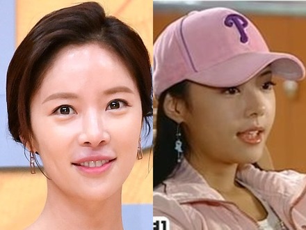 整形に失敗し、母から「顔を見たくもない」と言われる…韓国女優、憂うつな思いをした過去