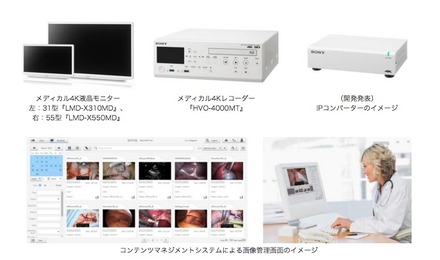 メディカル4K液晶モニターとメディカル4Kレコーダーの価格はオープン。コンテンツマネジメントシステムは対応サーバー構成により価格が異なる（画像はプレスリリースより）