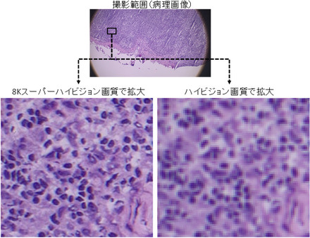 病理画像の拡大図。左が8Kスーパーハイビジョン画質、右は従来のハイビジョン画質。8K技術を活用して高画質な映像を遠隔地に伝えることで、従来の遠隔医療では対応が困難であった細かな病変の発見等が期待される（画像はプレスリリースより）