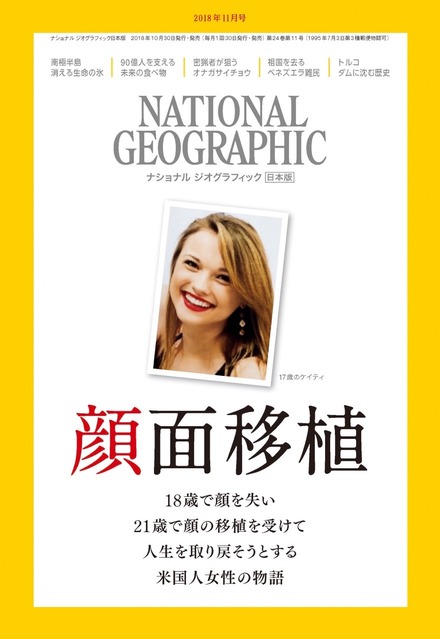 米国人女性の顔面移植を特集ーー10月30日発売『ナショナル ジオグラフィック日本版2018年11月号』