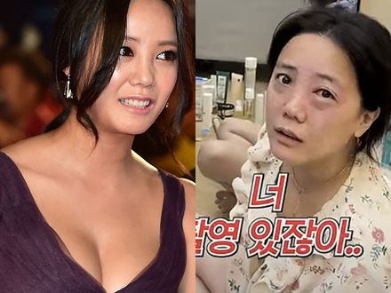 顔面トラブル続きの韓国女優、今度は異常な目の腫れに困惑「撮影直前に緊急事態」