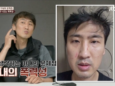 妻のDVで夫の眼球は破裂寸前に…“10カ月スピード婚”の韓国夫婦に起こった悲劇「離婚した方がいい」