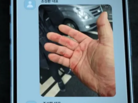 暴行の跡まで!! Ｊリーグのパワハラ問題に匹敵するか。韓国“ランシュー界の帝王”パワハラ事件の真相はいかに