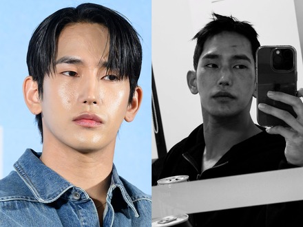 「鼻がC字に曲がった」Netflix恋リア『脱出おひとり島』出演者、鼻手術後の近況を報告