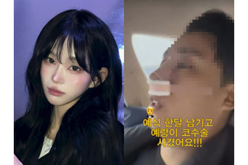 “整形モンスター”と自身も認めた韓国インフルエンサー、婚約者にも整形をさせる 亡き父は元巨人投手 画像