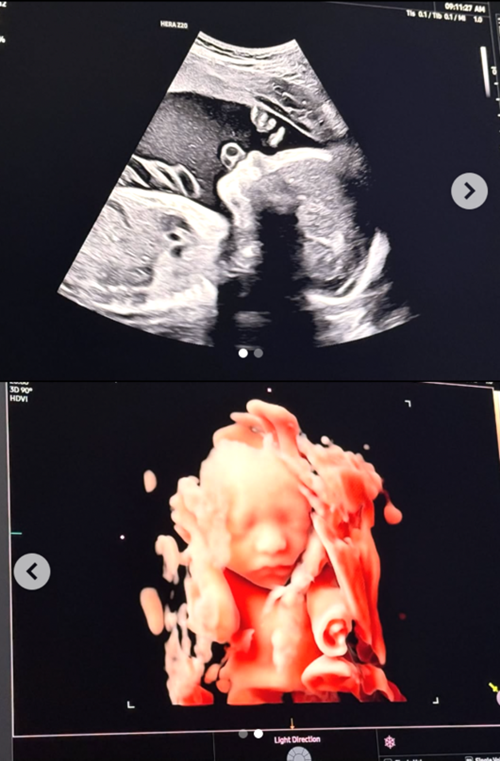 ソン・スンヒョン子ども