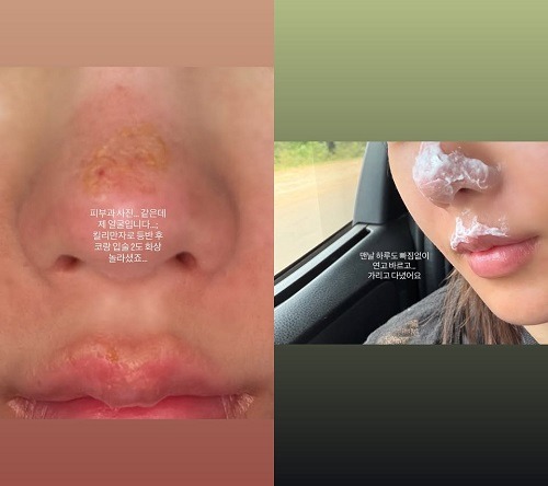 クォン・ウンビ